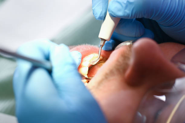 Best Emergency Root Canal Therapy in Barron, WI